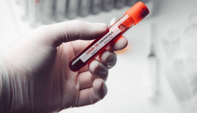 Coronavirus în România: 127 de cazuri noi, bilanțul total a urcat la 17.712 - coronavirusshutterstock166220443-1590142002.jpg