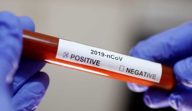 Angajată a ministerului Sănătății, infectată cu coronavirus. 12 persoane au fost izolate la domiciliu - coronavirustest-1597128808.jpg