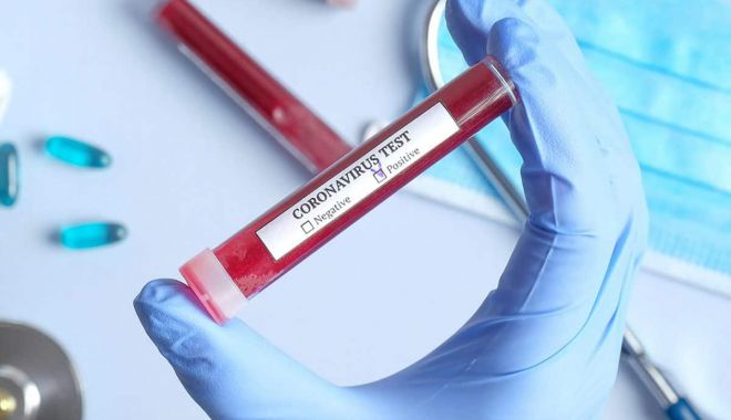 Un angajat al Ministerului Economiei a fost identificat cu coronavirus - coronavirustest1-1594834523.jpg