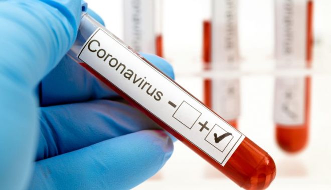 Record absolut de infectări cu coronavirus în Republica Moldova - coronavirustestingeverlywell-1591897736.jpg