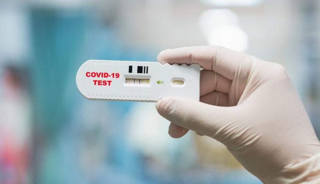 Aproape șase milioane de teste pentru Covid 19 vor fi disponibile în Regatul Unit - covid-1596454453.jpg