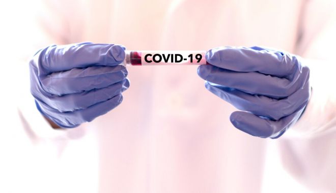 Situația COVID-19, la Constanța. 331 de teste, in 24 de ore - covid-1596915347.jpg