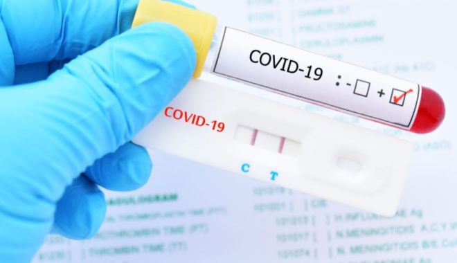 CORONAVIRUS / În ultimele 24 de ore au fost 73 de cazuri noi. Aproape 300 de decese COVID-19 raportate de autorități - covid-1624961154.jpg