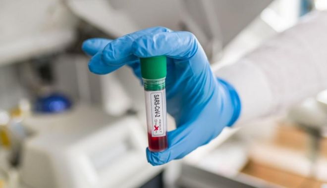 Coronavirus în România: Peste 800 de noi cazuri de COVID-19, dublu față de ziua de luni - covid111-1640080161.jpg