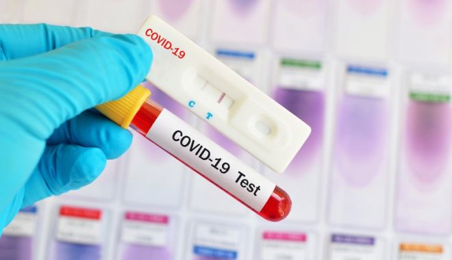 Intrarea românilor în Bosnia și Herțegovina, doar cu condiția prezentării unui test COVID-19 negativ - covid19test-1594915921.jpg