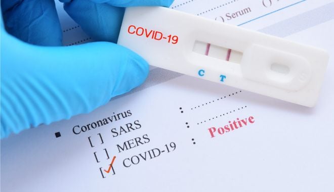 Bilanţ Covid-19: 1.256 cazuri noi de îmbolnăviri, 46 la Constanţa - covid19test-1619432522.jpg