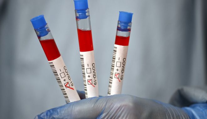 Coronavirus în România: ​51 de noi cazuri de COVID-19 și 4 decese, raportate în ultimele 24 de ore - covid2-1626174172.jpg