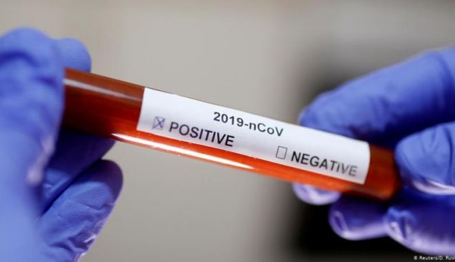 Coronavirus în România. 1.269 de cazuri noi au fost în registrate în ultimele 24 de ore - covidcoronavirus-1599301988.jpg