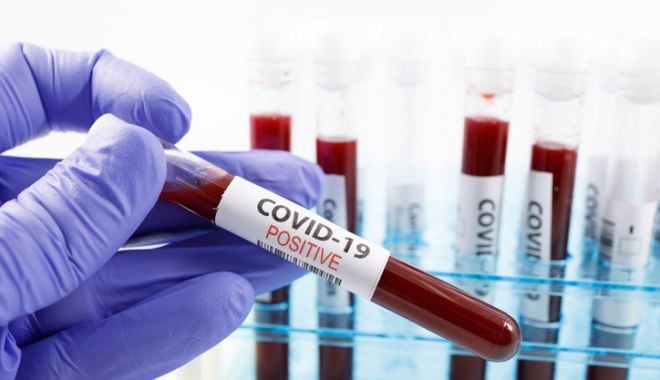 COVID-19. Incidenţa în continuă scădere, la Constanţa - covidpositive-1620383183.jpg