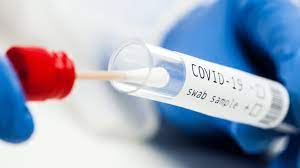 Teste gratuite anti-Covid în 120 de farmacii din România. Andrei Baciu: 
