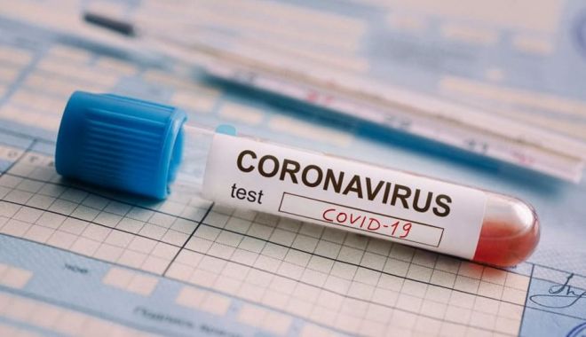 Nelu Tătaru: Suntem într-o perioadă descendentă în ceea ce privește cazurile de infectare cu COVID-19 - covidtest-1590163773.jpg
