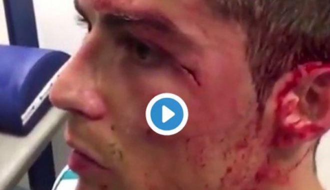 Imagini crunte cu Cristiano Ronaldo, accidentat - cristianoronaldo62822700-1516702390.jpg
