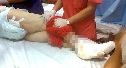 Caz șocant la Băneasa: bolnavă psihic, lăsată să moară pe un pat de spital (atenție, imagini șocante) - d094cba1b003a58311ff266a501efa25.jpg