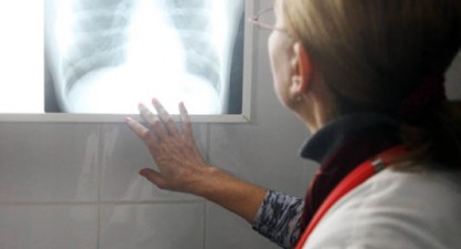 Pneumonia poate fi prevenită prin vaccinare - d81cf24d6c62e5b02a3deb8eddd847fe.jpg