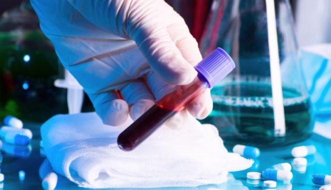 COVID-19 / Încă patru români infectați, decedați în străinătate - dd-1585564756.jpg