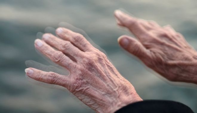 Ziua mondială de luptă împotriva bolii Parkinson - ddd-1586587344.jpg