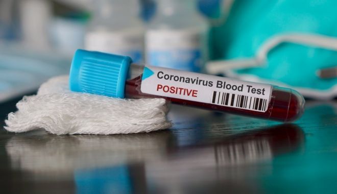 UN NOU CAZ DE CORONAVIRUS confirmat în România! Nu prezintă simptome - dddd-1583237076.jpg