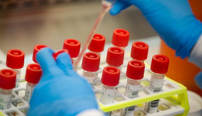 Test de coronavirus, autorizat de urgență în SUA - dddd-1584091984.jpg