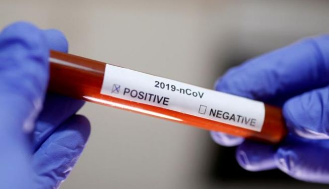 Bilanț negru.  400 de decese din cauza noului coronavirus, în România - deces1-1587113355.jpg