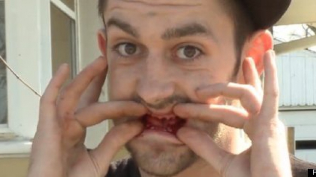 S-a trezit cu toți dinții scoși după ce a mers la dentist - dentist-1365687325.jpg