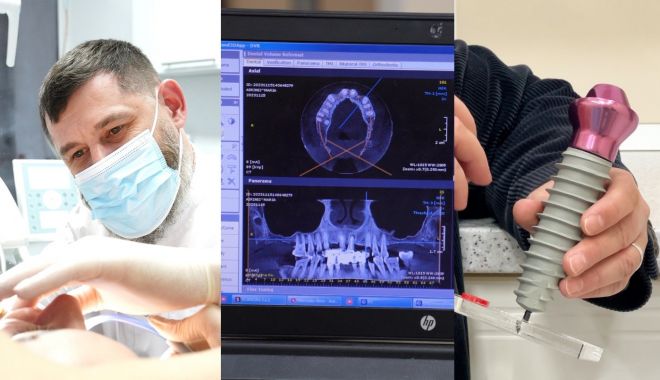 Alege dantura completă pe implanturi FIXO de la Clinicile Dr. Petru - dentist-1703699651.jpg