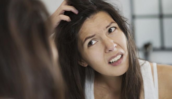 Dermatita seboreică este confundată foarte des cu mătreața - dermatita-seboreica-1701693042.jpg
