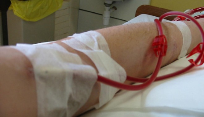 Metodă nouă de dializă, inventată de medicii români - dializa-1317658275.jpg