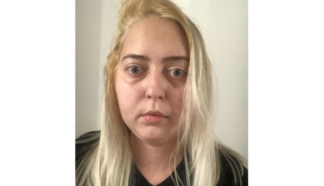 Șansă la viaţă! Apel umanitar pentru Diana, o tânără absolventă de Medicină, bolnavă de cancer - dianapopescu22-1625683181.jpg