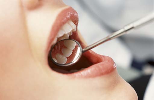 De ce trebuie să mergem de două ori pe an la dentist - dinti-1337204717.jpg