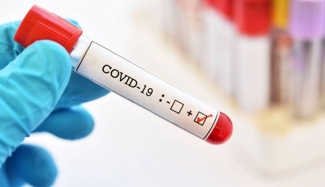 Coronavirus la Constanța. 25.194 de persoane au fost confirmate cu COVID până în prezent - dintre1832depersoanetestatesamba-1608922358.jpg