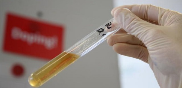 Atletism / Triplusaltistul Alexandru Baciu, DEPISTAT POZITIV la controlul antidoping - doping-1466785169.jpg