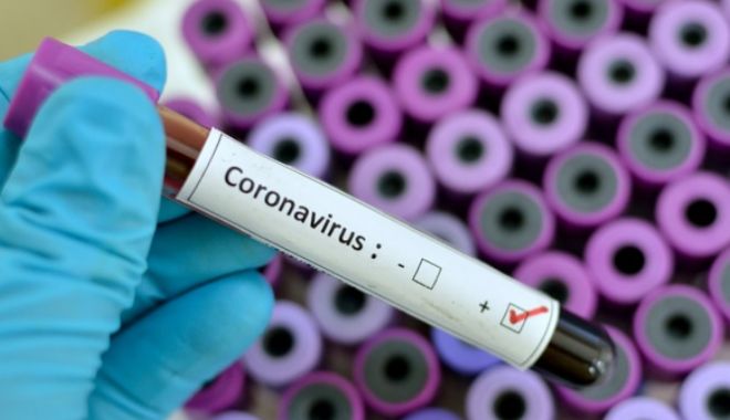 Două cazuri noi de infecție cu coronavirus, la Constanța - douacazurinoi-1588870051.jpg