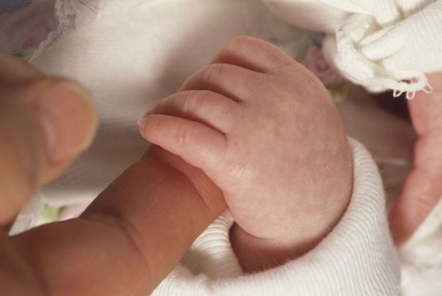 Concluzie NEAȘTEPTATĂ, în cazul bebelușului care a murit în timpul botezului! Ce spun medicii legiști, după necropsie - eczemaatipica-1505805048.jpg