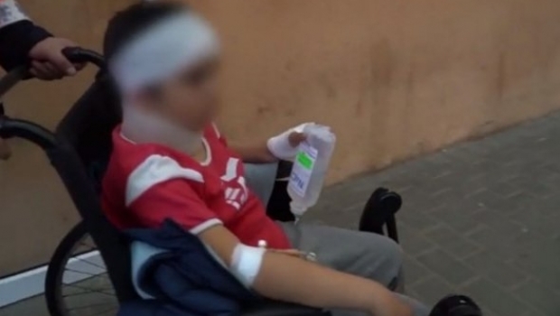 Copil de 11 ani, bătut măr la școală de tatăl unei colege. Băiatul a ajuns la Neurochirurgie - elev81849700-1575282918.jpg