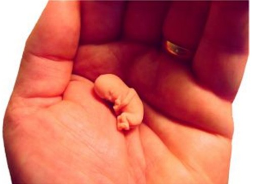 Cât de periculoase sunt avorturile pe plan global - embryophotoabortionhelp-1326961094.jpg