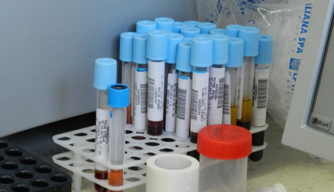 Campanie de luptă împotriva hepatitei - eprubete-1370770470.jpg
