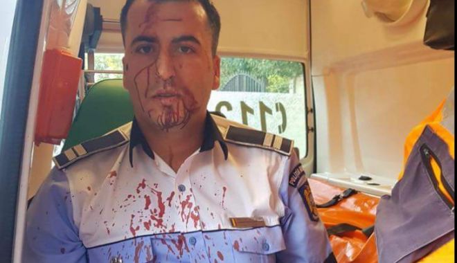 CLIPE TERIBILE ÎN TRAFIC! Polițist de la Rutieră, BĂTUT MĂR de un șofer - fbimg153738446394774528100-1537425904.jpg