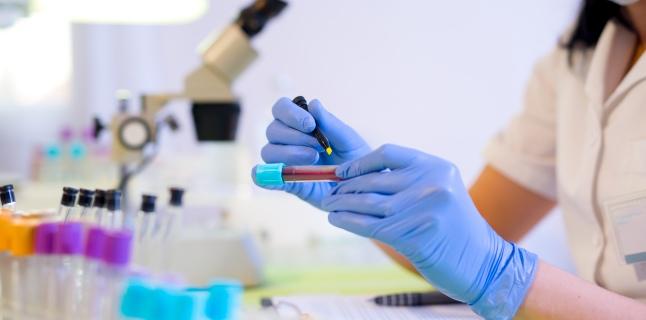 Reuniune de urgenţă a OMS privind epidemia de febră hemoragică - febrahemoragicasindromrenal64664-1676375158.jpg
