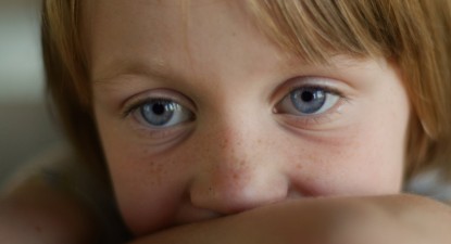 Pistruii au caracter ereditar, dar se înmulțesc prin expunerea la soare - ff14df1c5a7529b7ef7c847760a8f13f.jpg