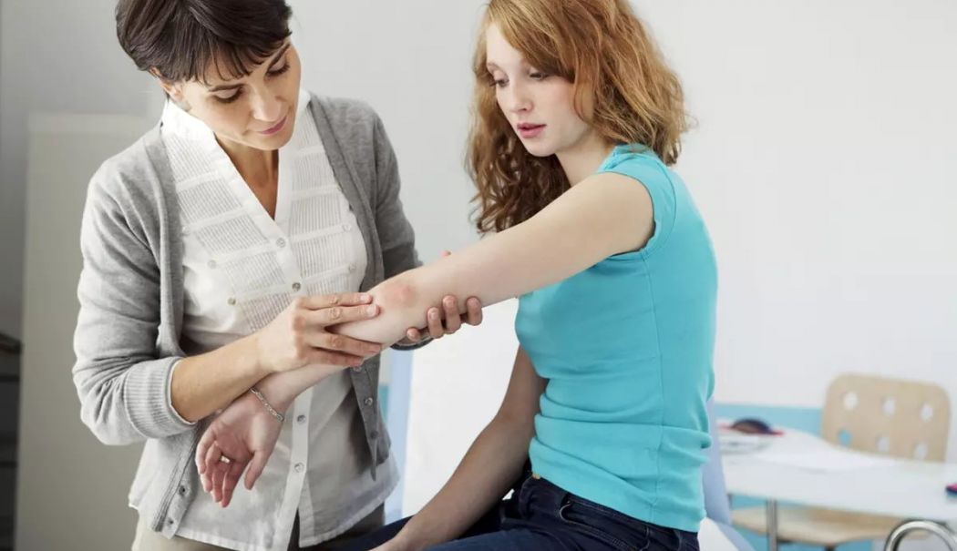 Psoriazisul nu poate fi vindecat, dar poate fi 