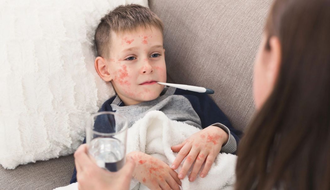Simptomele rujeolei apar la aproximativ două săptămâni de la infectare - fond-rujeola-1728044062.jpg