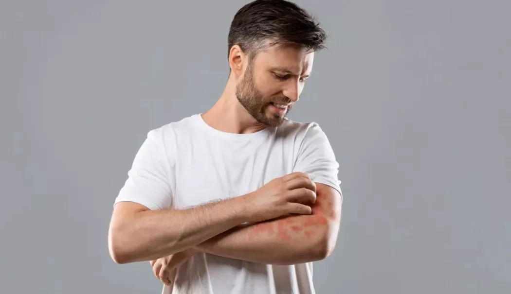 Alimente care ameliorează urticaria. Ce să eviți și ce să adaugi în farfurie - fond-urticarie-1769688523.webp