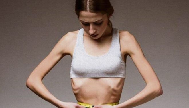 Fuga de mâncare! Atenţie la primele semne de anorexie, la adolescenți - fondanorexia-1652620956.jpg