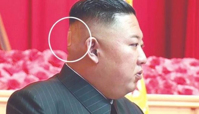 Bandajul de pe ceafa lui Kim Jong Un ridică multe semne de întrebare - fondbun-1628082551.jpg
