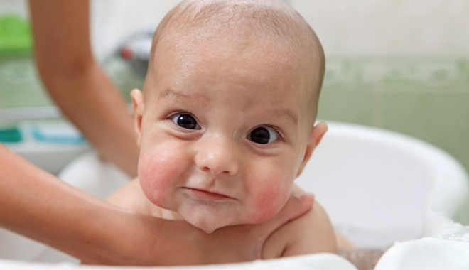 Greșelile care duc la declanșarea dermatitei atopice. Sfaturi pentru a preveni și trata această afecțiune - fonddermatitaatopica-1472051826.jpg