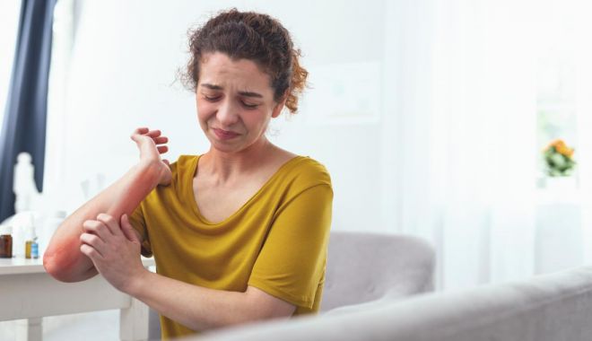 Înţepăturile de albine vă pot pune, uneori, viaţa în pericol - fondintepaturi3-1658857001.jpg