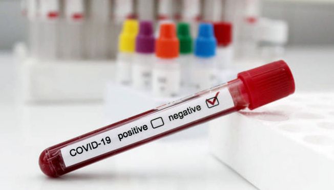 FC Viitorul / Testele pentru coronavirus - negative! - fotbal-1600430244.jpg