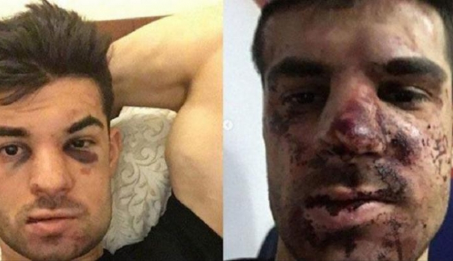 Un fotbalist a fost bătut cu bestialitate din cauza unui loc de parcare - fotbalist-1512199795.jpg