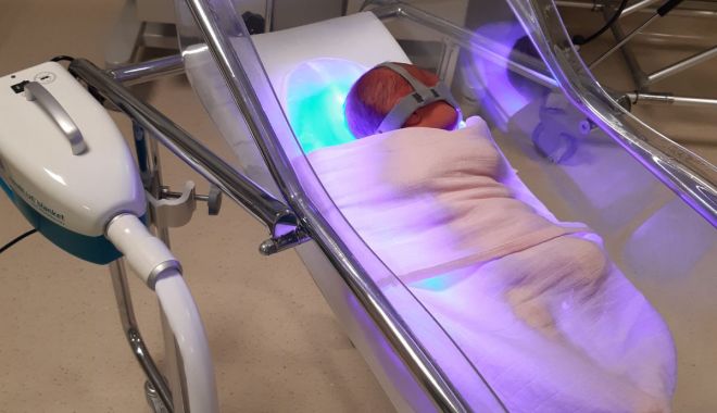 Fototerapia este indicată în cazul icterului la copii - fototerapie2-1637507845.jpg