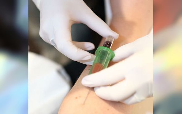 Reducerile continuă la testările pentru depistarea hepatitei C - g6fbb972a150e308bd66c619d735d940-1345243197.jpg